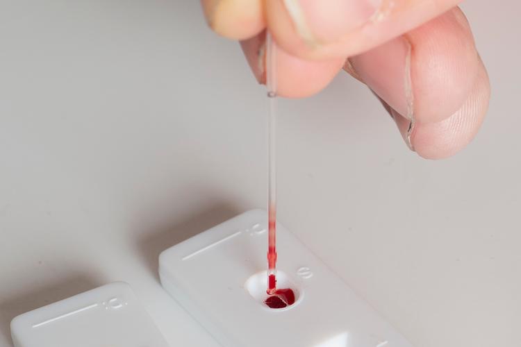 Foto: Mikkel Hørlyck/POLFOTO