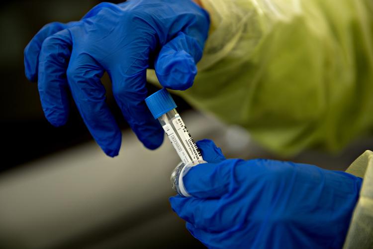 Tal fra Statens Serum Institut viser, at antallet af coronaindlagte er det laveste siden midten af marts. Foto: Jacob Ehrbahn/POLFOTO