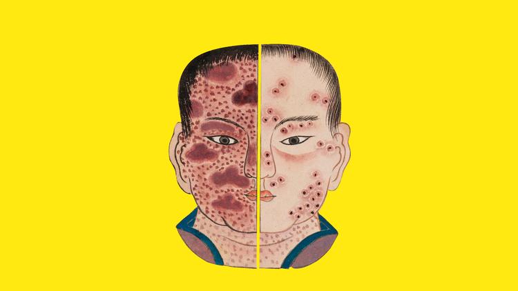 Foto: Wellcome Collection