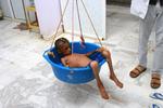 Lægerne vejer den underernærede dreng Hassan Merzam Muhammad på et hospital i Hajjah-provinsen i Yemen.  Foto: Stringer/Ritzau Scanpix