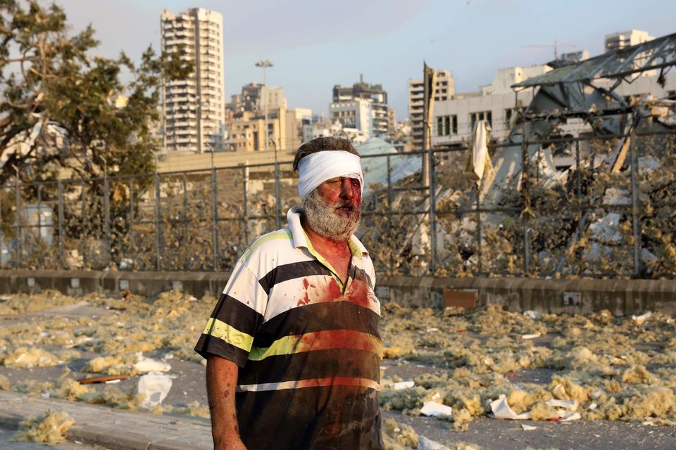 Foto: Anwar Amro/Ritzau Scanpix