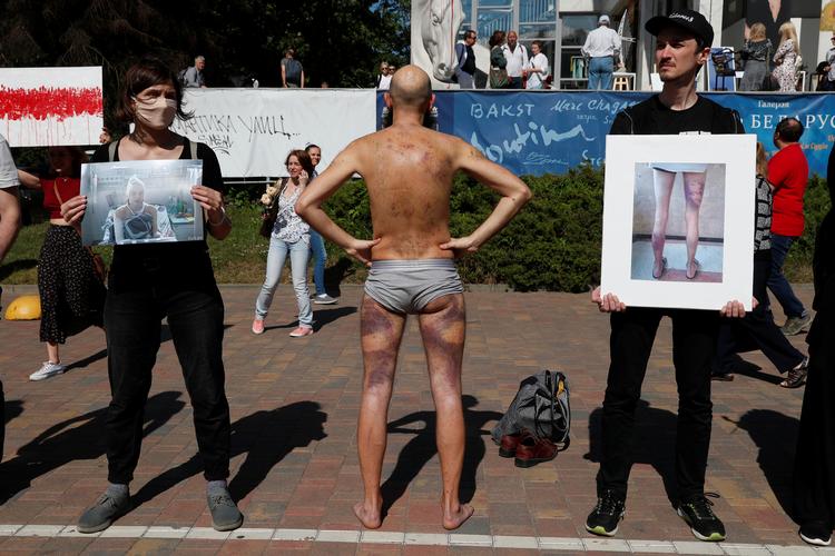 Tæsk. Som mange andre demonstranter har også Artyom Pronin måttet smage politiets knipler. Her viser han sine blå mærker frem på en demonstration imod politibrutalitet i Minsk. Foto: Vasily Fedosenko/Ritzau Scanpix