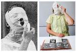 Bagsiden gnider en isklump pakket ind i en serviet hen over ansigtet pakket ind i våde omslag og omviklet med gazebind  - ligesom i 1948. 