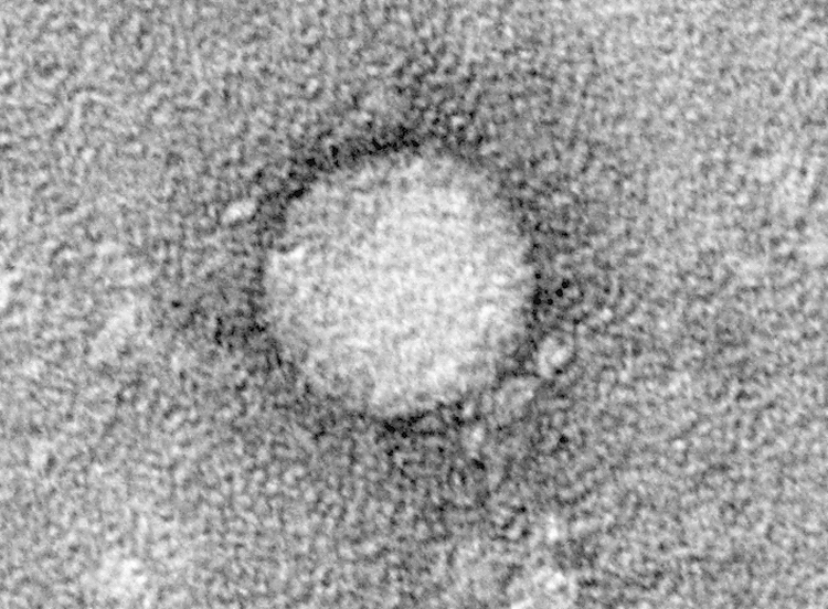 Den ser ikke ud af alverden, men den mikroskopiske virus hepatitis C har taget livet af millioner af mennesker. En forskertrio har i dag fået tildelt Nobelprisen i Medicin for at have opdaget den tilbage i 1989. Foto: The Rockefeller University