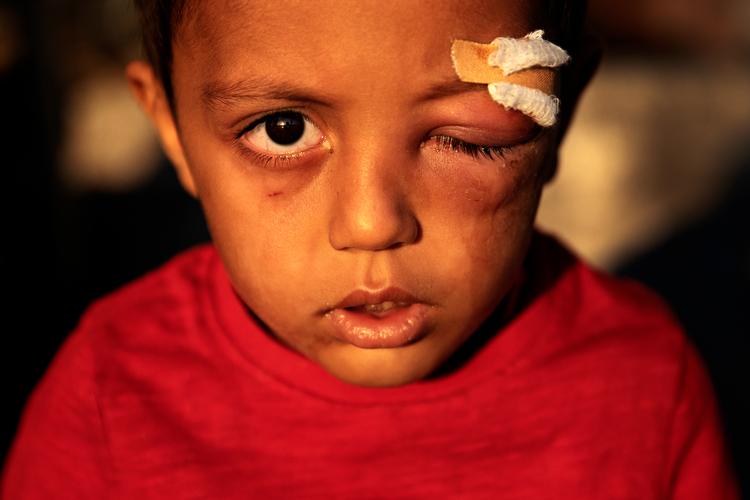 Foto: Jacob Ehrbahn/POLFOTO