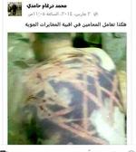 Syrisk tortur - sådan så aktivisten Mohammed Hamdi's ryg ud efter mishandling i et af Assads arrresthuse. Foto: Finn Frandsen/POLFOTO