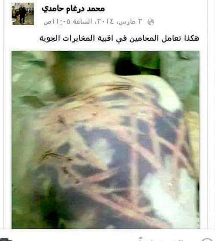 Syrisk tortur - sådan så aktivisten Mohammed Hamdi's ryg ud efter mishandling i et af Assads arrresthuse. Foto: Finn Frandsen/POLFOTO