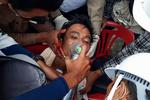     En mand får ilt af redningsfolk i  Dawei, hvor politiet angiveligt har skudt med skarpt mod demonstranterne. Foto: Handout/Ritzau Scanpix
