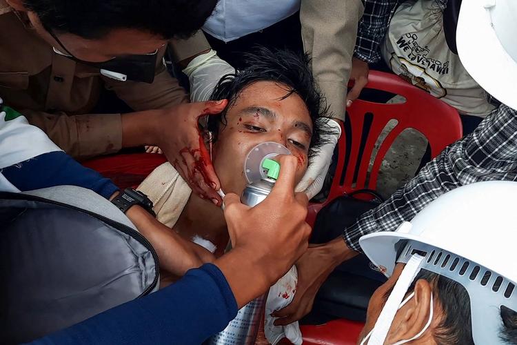     En mand får ilt af redningsfolk i  Dawei, hvor politiet angiveligt har skudt med skarpt mod demonstranterne. Foto: Handout/Ritzau Scanpix