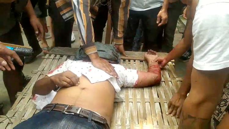 En demonstrant får behandling, efter at han i lørdags blev såret ved en demonstration i byen Mandalay i Myanmar.  Foto: Video Obtained By Reuters/Ritzau Scanpix