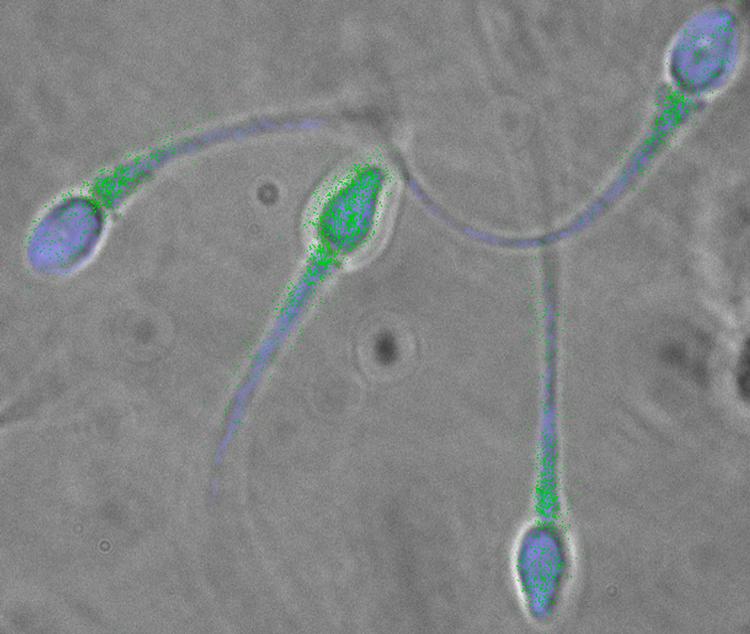 Vi har et kæmpestort sædproblem i den vestlige verden. Heldigvis viser nyere forskning, at man faktisk godt kan gøre noget ved det.  Foto: Ho/Ritzau Scanpix