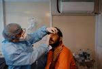 En læge på et hospital ved New Delhi tjekker øjnene hos en patient med mucormykose. Hos en del patienter må øjet fjernes, for at de kan overleve. Foto: Adnan Abidi/Ritzau Scanpix