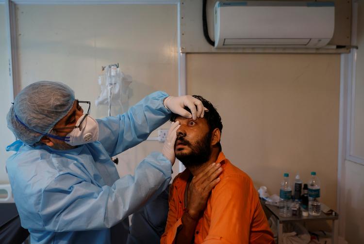 En læge på et hospital ved New Delhi tjekker øjnene hos en patient med mucormykose. Hos en del patienter må øjet fjernes, for at de kan overleve. Foto: Adnan Abidi/Ritzau Scanpix