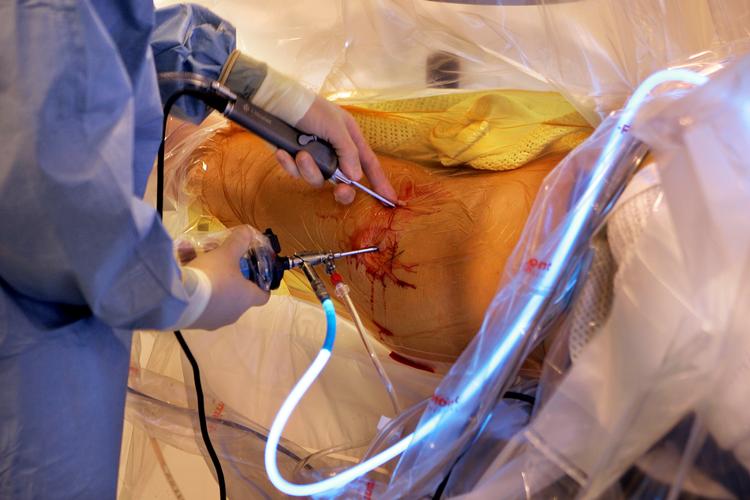 Hofteoperationer er nogle af dem, der kan være lang ventetid på. Men ventetiden varierer fra region til region. Arkivfoto Foto: Finn Frandsen