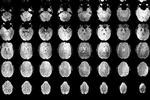 Et studie har vist høj aktivitet af gamma-bølger 15 sekunder inden og efter et dødsfald. Scanningerne på billedet er ikke fra det omtalte studie. Foto: Jens Hartmann