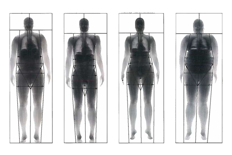 bodyage_topillu