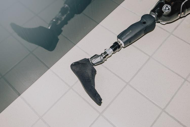 Det var i Region Midtjylland, at sagen om muligvis unødvendige amputationer begyndte. Op mod 90 årlige benamputationer kunne måske have været undgået med bedre forebyggende behandling. Foto: Jens Hartmann/Jens Hartmann