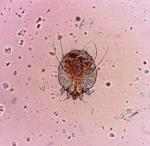 Sådan ser en fnatmide ud, når man forstørrer den ret mange gange. I virkeligheden er den 0,3 millimeter lang. Foto: Vladimir064