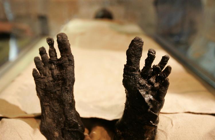 »Man skulle tro, at det var umuligt at såre et 3.000 år gammelt lig«, indleder tabloidavisen Daily Mail sin historie om, hvad museerne skal kalde resterne af afdøde egyptere. Her er det den mumificerede kong Tutankhamuns fødder. Foto: Ben Curtis/AP