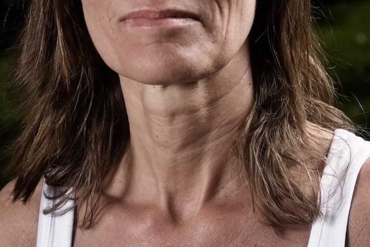 Alle kvinder, der ikke dør, før de når den, kommer i overgangsalderen. Nogle har mange gener, andre ingen. Man ved ikke hvor mange eller hvorfor.  Foto: Valdemar Jørgensen