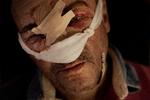 Krig i Ukraine. Et militærhospital i Donbas tager imod sårede ukrainske soldater, her en anonym ukrainsk soldat.
 Foto: Mads Nissen/POLITIKEN