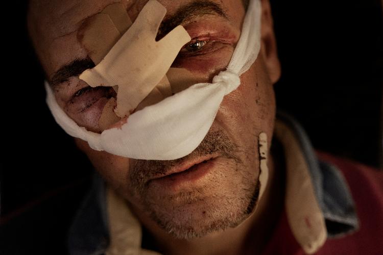 Krig i Ukraine. Et militærhospital i Donbas tager imod sårede ukrainske soldater, her en anonym ukrainsk soldat.
 Foto: Mads Nissen/POLITIKEN