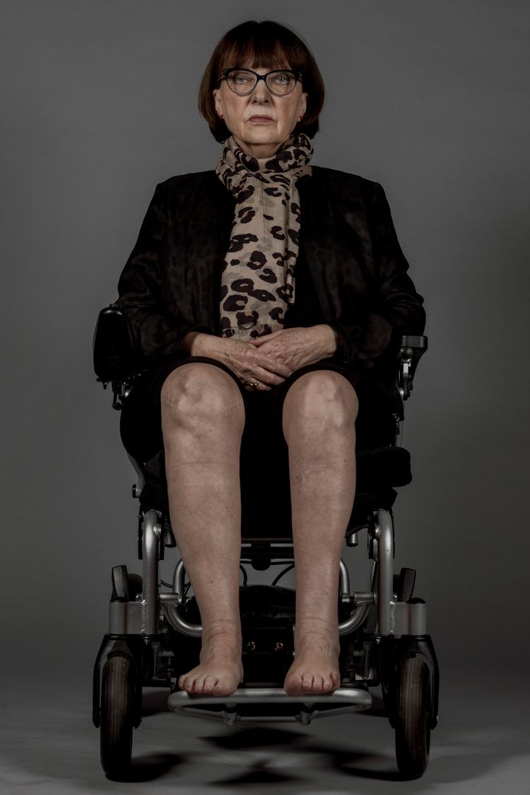 Lisbet Lange er 76 år og har kæmpet mod følgerne af polio, siden hun blev ramt i 1948. ”Fra jeg begyndte i gymnasiet, har jeg altid gået i bukser. Så kunne jeg gemme det tynde ben. Selvfølgelig har det alligevel været tydeligt.” Foto: Christian Falck Wolff