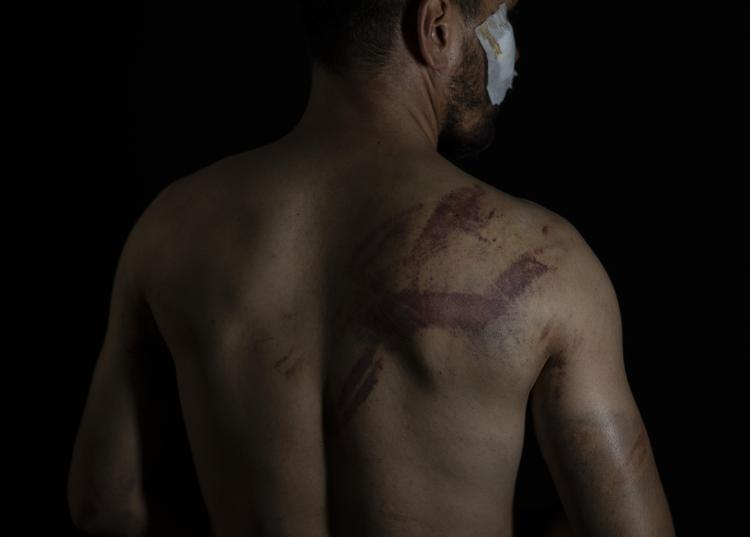 Ifølge FN's rapport er 274 mænd, 58 kvinder og 2 drenge blevet pisket offentligt i Afghanistan i de seneste seks måneder. Foto: Bernat Armangue/Ritzau Scanpix