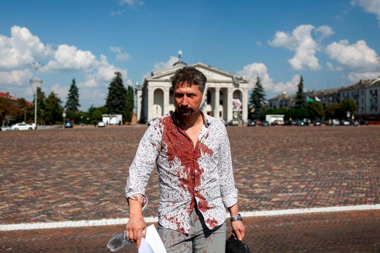 Antallet af dræbte og sårede ved angrebet på Tjernihiv i Ukraine lørdag blev senere på dagen opjusteret til 7 dræbte og 144 sårede. Foto: Anatolii Stepanov/Ritzau Scanpix