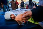  De civile i Gaza lider både under bombardementer, blokade og mangel på nødhjælp.  Her trøster en mor sit sårede barn på Nasser Hospitalet i Khan Yunis i det sydlige Gaza.  Foto: Mahmud Hams/Ritzau Scanpix