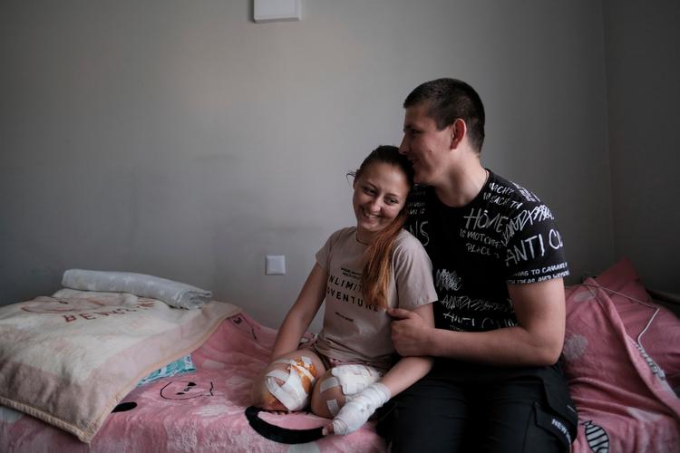 23-årige Oksana Balandina er en af dem, der betaler prisen for landminerne i Ukraine. Hun mistede sine ben i Lysjansk i Østukraine. Hun blev gift med sin Viktor Vasyliv, da hun bagefter var indlagt på sygehuset. Foto: Hiroto Sekiguchi/Ritzau Scanpix