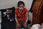 Mange af de sårede børn, der ankommer til hospitalerne i Gaza får betegnelsen WCNSF, som betyder 'såret barn, ingen overlevende familiemedlemmer', skriver BBC. Foto: Ibraheem Abu Mustafa/Ritzau Scanpix