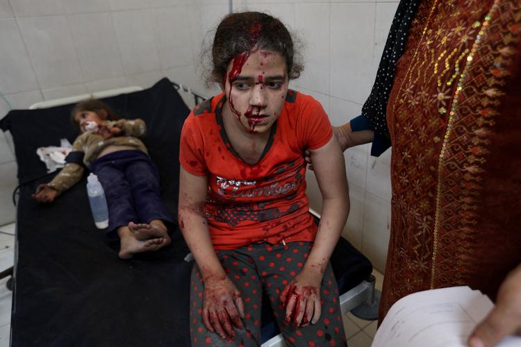 Mange af de sårede børn, der ankommer til hospitalerne i Gaza får betegnelsen WCNSF, som betyder 'såret barn, ingen overlevende familiemedlemmer', skriver BBC. Foto: Ibraheem Abu Mustafa/Ritzau Scanpix