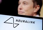 Elon Musk ejer selskabet Neuralink, som har produceret den chip, der er blevet opereret ind i hjernen på et menneske.  Foto: Dado Ruvic/Ritzau Scanpix