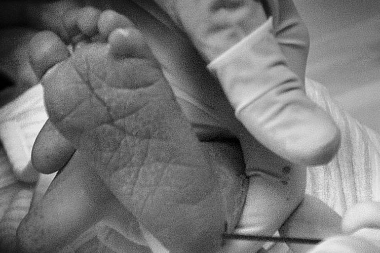 Blodprøver fra alle spædbørn havner i et stort biologisk arkiv på Statens Serum Institut. De færreste forældre ved, hvor blodprøven ender.   Anna Toft kom til verden den 24. september på Rigshospitalet. Her får hun, 5 dage gammel, taget en blodprøve fra hælen, der skal indgå i PKU-banken på Statens Serum Institut. Hendes forældre, Mette Jensen og Søren Toft, var ikke klar over, at blodprøven ville havne i et arkiv, men de går begge ind for et eventuelt fremtidigt dna-register. Arkivfoto Finn Frandsen
