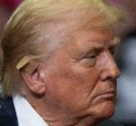 Donald Trump har skiftet forbindingen, han har haft på øret, ud med et plaster. Foto: Bill Pugliano/Ritzau Scanpix