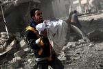 Barnet på billedet er lige blevet reddet ud af ruinerne af en bygning, efter Assads regime angreb byen Ghouta fra luften. Foto Abdulmonam Eassa/AFP/