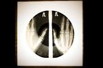 LP-plade med røntgenbillede trykt på. 