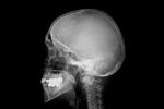 »Når patienterne bruger ord som ’kamp’ eller ’rejse’, spørger vi: Hvad ligger der i det for dig? Og hvad er det for dig? Jeg hører aldrig sygeplejerskerne sige: Vi kæmper kampen sammen. Det bruger de simpelt hen ikke«, siger Susanne Thorhauge Bech fra Aalborg Universitetshospitals onkologiske dagafsnit. Arkivfoto Erich Ferdinand 