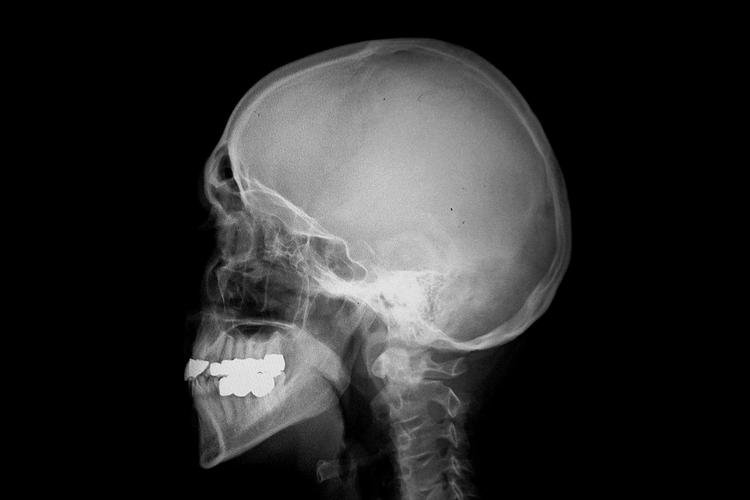 »Når patienterne bruger ord som ’kamp’ eller ’rejse’, spørger vi: Hvad ligger der i det for dig? Og hvad er det for dig? Jeg hører aldrig sygeplejerskerne sige: Vi kæmper kampen sammen. Det bruger de simpelt hen ikke«, siger Susanne Thorhauge Bech fra Aalborg Universitetshospitals onkologiske dagafsnit. Arkivfoto Erich Ferdinand 