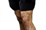 Sådan nogle behårede mandeben skal gemmes væk på mange danske arbejdspladser. Men hvis du er britisk prins, SKAL du gå med shorts, indtil du fylder otte år – i hvert fald hvis der er fotografer til stede. 
 /POLFOTO