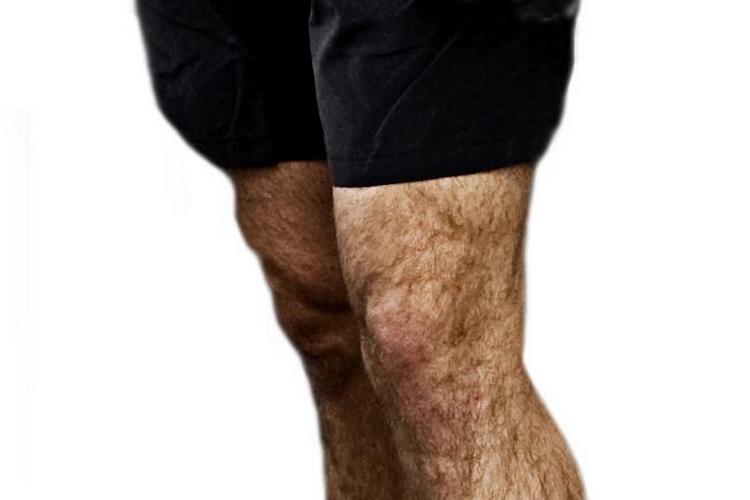 Sådan nogle behårede mandeben skal gemmes væk på mange danske arbejdspladser. Men hvis du er britisk prins, SKAL du gå med shorts, indtil du fylder otte år – i hvert fald hvis der er fotografer til stede. 
 /POLFOTO