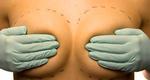 Brystoperation_iStock_00000