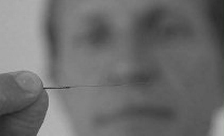 Nåle i ørerne hjælper mod abstinenser for alhohol, medicin og stoffer. Foto: Jens Dresling 