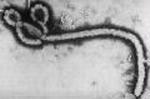 UN GABON EBOLA