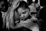 AIDS projekt i Malawi
