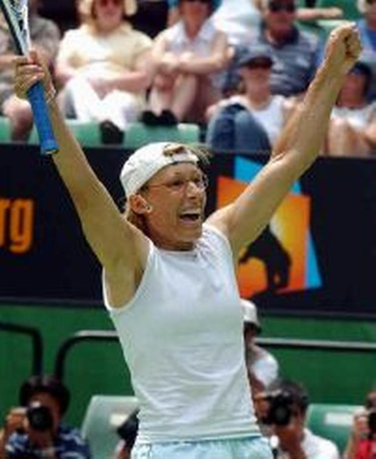 Foto: AP 