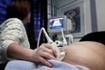 Ultralydsscannere stjæles fra danske hospitaler og privatklinikker. Arkivfoto: Kim Nielsen. 
