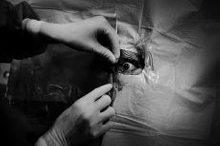 Amterne fyrer 13 privatpraktiserende øjenlæger. - Arkivfoto: Martin Lehmann 
