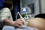 I modsætning til danskerne vælger norske kvinder at føde børn med alvorlige sygdomme, der afsløres under ultralydsscanninger og fosterdiagnostik. - Arkivfoto: Kim Nielsen 